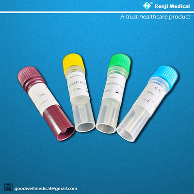 Approvazione in tempo reale di metodo ISO13485 di Renji Nucleic Acid Testing Kit RT-PCR