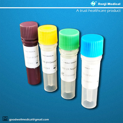 50 prove/corredo nucleico prova acida del corredo, certificazione del CE del corredo di rilevazione del coronavirus