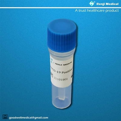 Prova Kit Oropharyngeal Nasopharyngeal della casa di sensibilità Sars-Cov-2 di 95%